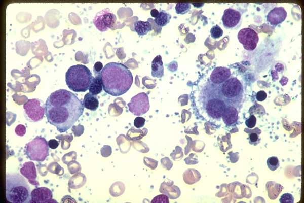 Nucleated Red Blood Cells (NRBC)