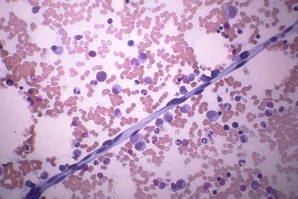 Non-hemopoietic Cells